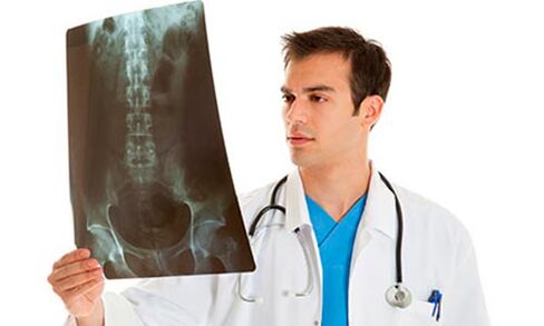 The doctor looks at X-rays to diagnose low back pain